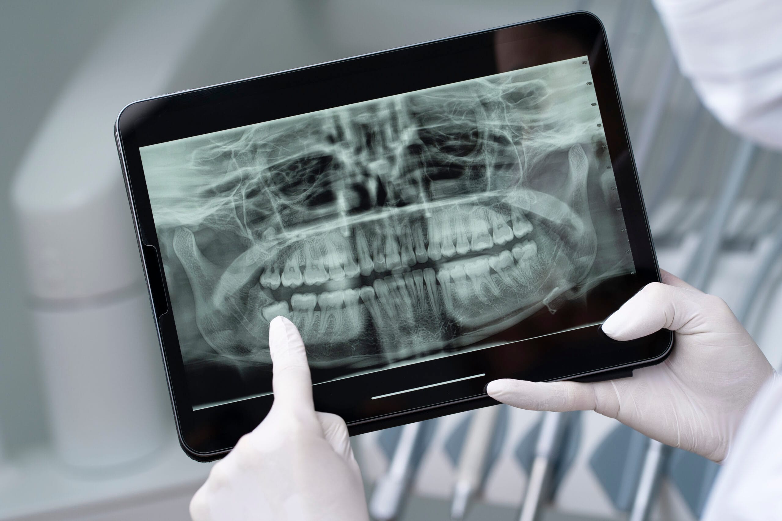 Oral Medicine and Radiology scaled